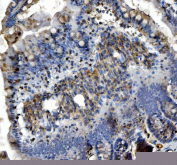 IHC staining of FFPE rat colon tissue with Insulin receptor substrate 2 antibody. HIER: boil tissue sections in pH8 EDTA for 20 min and allow to cool before testing.