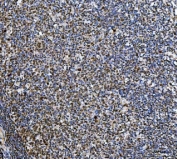 IHC staining of FFPE human tonsil tissue with Ki-67 antibody. HIER: boil tissue sections in pH8 EDTA for 20 min and allow to cool before testing.