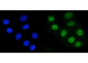 Immunofluorescent staining of FFPE human SiHa cells with RAD21 antibody (green) and DAPI nuclear stain (blue). HIER: steam section in pH6 citrate buffer for 20 min.