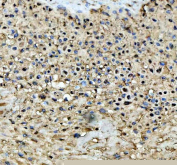 IHC staining of FFPE human placental tissue with STAT6 antibody, HRP-labeled secondary and DAB substrate. HIER: boil tissue sections in pH8 EDTA for 20 min and allow to cool before testing.