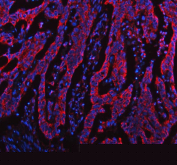 Immunofluorescent staining of FFPE human colon cancer tissue with TOMM20 antibody (red) and DAPI nuclear stain (blue). HIER: steam section in pH8 EDTA buffer for 20 min.