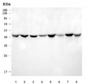 Western blot testing of 1) human HeLa, 2) human Jurkat, 3) human 293T, 4) human CCRF-CEM, 5) rat brain, 6) rat lung, 7) mouse brain and 8) mouse lung tissue lysate with NDUFS2 antibody. Expected molecular weight ~49 kDa.