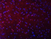 Immunofluorescent staining of FFPE rat brain tissue with Septin 2 antibody (red) and DAPI nuclear stain (blue). HIER: steam section in pH8 EDTA buffer for 20 min.