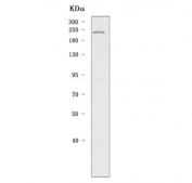 Western blot testing of mouse testis tissue lysate with DNA methyltransferase 1 antibody. Predicted molecular weight: 180-200 kDa.
