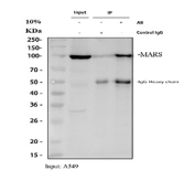 Immunoprecipitation of MARS1 protein from 500ug of human A549 whole cell lysate with 2ug of MARS1 antibody.