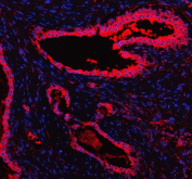 Immunofluorescent staining of FFPE human prostate cancer tissue with MARS1 antibody (red) and DAPI nuclear stain (blue). HIER: steam section in pH8 EDTA buffer for 20 min.