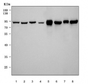 Western blot testing of 1) human HeLa, 2) human U-87 MG, 3) human Jurkat, 4) human SH-SY5Y, 5) rat skeletal muscle, 6) rat brain, 7) mouse skeletal muscle and 8) mouse brain tissue lysate with ACO2 antibody. Predicted molecular weight: ~85 kDa.