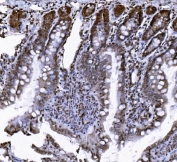 IHC staining of FFPE rat colon tissue with TER ATPase antibody. HIER: boil tissue sections in pH8 EDTA for 20 min and allow to cool before testing.