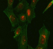 Immunofluorescent staining of FFPE human U-2 OS cells with Glycogen synthase kinase-3 beta antibody (red) and Beta Tubulin mAb (green). HIER: steam section in pH6 citrate buffer for 20 min.