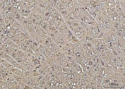 IHC staining of FFPE rat brain tissue with YWHAE antibody. HIER: boil tissue sections in pH8 EDTA for 20 min and allow to cool before testing.