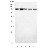 Western blot testing of 1) human SiHa, 2) human HeLa, 3) human HEL, 4) rat brain and 5) mouse brain tissue lysate with ADAR2 antibody. Expected molecular weight: 80-90 kDa.