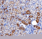 IHC staining of FFPE rat kidney tissue with Inosine-5'-monophosphate dehydrogenase 2 antibody, HRP-secondary and DAB substrate. HIER: boil tissue sections in pH8 EDTA for 20 min and allow to cool before testing.