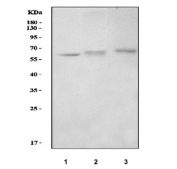 Western blot testing of 1) rat pancreas, 2) mouse lung and 3) mouse pancreas tissue lysate with Inosine-5'-monophosphate dehydrogenase 2 antibody. Predicted molecular weight: ~56 kDa.