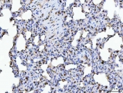 IHC staining of FFPE rat lung tissue with ERP29 antibody. HIER: boil tissue sections in pH8 EDTA for 20 min and allow to cool before testing.