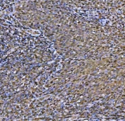 IHC staining of FFPE human tonsil tissue with MAT2A antibody. HIER: boil tissue sections in pH8 EDTA for 20 min and allow to cool before testing.