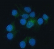 Immunofluorescent staining of FFPE human MCF7 cells with HO-2 antibody (green) and DAPI nuclear stain (blue). HIER: steam section in pH6 citrate buffer for 20 min.