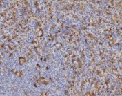 IHC staining of FFPE human spleen tissue with Malic enzyme 1 antibody. HIER: boil tissue sections in pH8 EDTA for 20 min and allow to cool before testing.