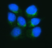 Immunofluorescent staining of FFPE human MCF7 cells with ERGIC1 antibody (green) and DAPI nuclear stain (blue). HIER: steam section in pH6 citrate buffer for 20 min.