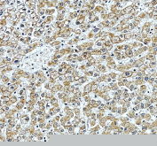 IHC staining of FFPE human liver tissue with Protein O-glucosyltransferase 3 antibody, HRP-secondary and DAB substrate. HIER: boil tissue sections in pH8 EDTA for 20 min and allow to cool before testing.