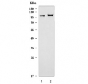 Western blot testing of 1) rat brain and 2) mouse brain tissue lysate with Toll-like receptor 5 antibody. Expected molecular weight ~98 kDa.