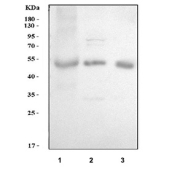 Western blot testing of 1) human placenta, 2) rat brain and 3) mouse brain tissue with ADRA2A antibody. Predicted molecular weight ~49 kDa.