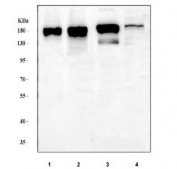 Western blot testing of 1) human HeLa and 2) human A549, 3) rat C6 and 4) mouse brain tissue lysate with INF2 antibody. Predicted molecular weight ~136 kDa, routinely observed at 170-180 kDa.