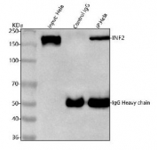 Immunoprecipitation of INF2 protein from 500ug of human HeLa whole cell lysate with 2ug of INF2 antibody.