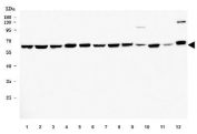 Western blot testing of 1) human MCF7, 2) human HeLa, 3) human A549, 4) human PC-3, 5) human A431, 6) human U-87 MG, 7) human HaCaT, 8) human T-47D, 9) rat pancreas, 10) rat PC-12, 11) mouse small intestine and 12) mouse HEPA1-6 cell lysate with TFG antibody. Predicted molecular weight ~43 kDa, commonly observed at 50-60 kDa.