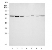 Western blot testing of 1) human HeLa, 2) human HepG2, 3) human MOLT4, 4) rat testis, 5) rat PC-12, 6) mouse testis and 7) mouse NIH 3T3 cell lysate with TKTL1 antibody. Predicted molecular weight ~65 kDa.