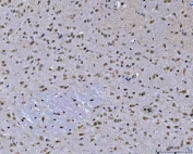 IHC staining of FFPE mouse brain tissue with ZMYND8 antibody. HIER: boil tissue sections in pH8 EDTA for 20 min and allow to cool before testing.