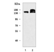 Western blot testing of human 1) 293T and 2) MCF7 cell lysate with ZMYND8 antibody. Predicted molecular weight ~132 kDa, commonly observed at 132-180 kDa.