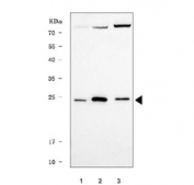 Western blot testing of human 1) MCF7, 2) 293T and 3) HepG2 cell lysate with TRIR antibody. The predicted molecular weight of TRIR is ~18 kDa, commonly observed at 18-28 kDa.