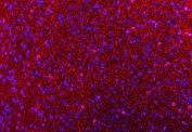 Immunofluorescent staining of FFPE mouse brain tissue with CNP antibody (red) and DAPI nuclear stain (blue). HIER: boil tissue sections in pH8 EDTA for 20 min and allow to cool before testing.