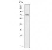 Western blot testing of human RT4 cell lysate with SCNN1A antibody. Predicted molecular weight ~76 kDa.