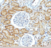 IHC staining of FFPE human kidney tissue with ATF6 antibody, HRP-secondary and DAB substrate. HIER: boil tissue sections in pH8 EDTA for 20 min and allow to cool before testing.