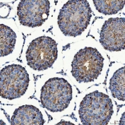 IHC staining of FFPE rat testis tissue with SEC23IP antibody. HIER: boil tissue sections in pH8 EDTA for 20 min and allow to cool before testing.