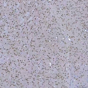 IHC staining of FFPE mouse brain tissue with SF3a60 antibody. HIER: boil tissue sections in pH8 EDTA for 20 min and allow to cool before testing.