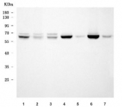 Western blot testing of 1) human HeLa, 2) human 293T, 3) human MCF7, 4) rat brain, 5) rat pancreas, 6) mouse brain and 7) mouse pancreas tissue lysate with AHCYL1 antibody. Predicted molecular weight ~59 kDa.