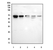 Western blot testing of 1) human SH-SY5Y, 2) human 293T, 3) human SiHa, 4) human U-251 and 5) mouse lung tissue lysate with TULP3 antibody. Predicted molecular weight: 50-57 kDa and ~19 kDa (multiple isoforms).