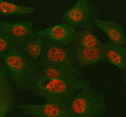 Immunofluorescent staining of FFPE human U-2 OS cells with TULP3 antibody (red) and Alpha Tubulin mAb (green). HIER: steam section in pH6 citrate buffer for 20 min.