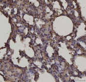 IHC staining of FFPE rat lung tissue with AGER antibody. HIER: boil tissue sections in pH8 EDTA for 20 min and allow to cool before testing.