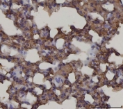IHC staining of FFPE mouse lung tissue with AGER antibody. HIER: boil tissue sections in pH8 EDTA for 20 min and allow to cool before testing.
