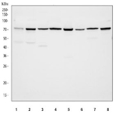 Western blot testing of 1) human RT4, 2) human U-251, 3) rat testis, 4) rat liver, 5) rat RH35, 6) mouse testis, 7) mouse liver and 8) mouse HEPA1-6 cell lysate with SIAE antibody. Predicted molecular weight ~58 kDa but may be observed at higher molecular weights due to glycosylation.