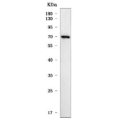 Western blot testing of human RT4 cell lysate with SIAE antibody. Predicted molecular weight ~58 kDa but may be observed at higher molecular weights due to glycosylation.