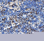 IHC staining of FFPE mouse spleen tissue with PAO-1 antibody, HRP-secondary and DAB substrate. HIER: boil tissue sections in pH8 EDTA for 20 min and allow to cool before testing.