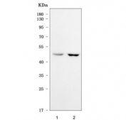 Western blot testing of human 1) 293T and 2) K562 cell lysate with Sorting Nexin 5 antibody. Predicted molecular weight ~47 kDa.