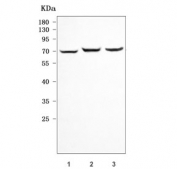 Western blot testing of 1) rat PC-12, 2) rat thymus and 3) mouse RAW264.7 cell lysate with Antigen peptide transporter 1 antibody. Predicted molecular weight ~79 kDa.