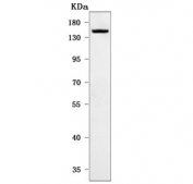 Western blot testing of human HeLa cell lysate with Hamartin antibody. Expected molecular weight: 130-150 kDa.