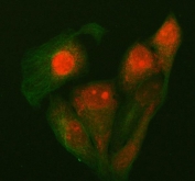 Immunofluorescent staining of FFPE human HeLa cells with P15RS antibody (red) and Alpha Tubulin mAb (green). HIER: steam section in pH6 citrate buffer for 20 min.