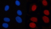 Immunofluorescent staining of FFPE human U-2 OS cells with RANBP2 antibody (red) and DAPI nuclear stain (blue). HIER: steam section in pH6 citrate buffer for 20 min.